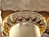 21の頭を持つ柱 - 聖ペテロとポール教会(©ジャン・エスピラ)
